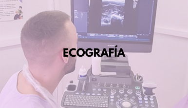 ECOGRAFIA FISIOTERAPIA CORDOBA
